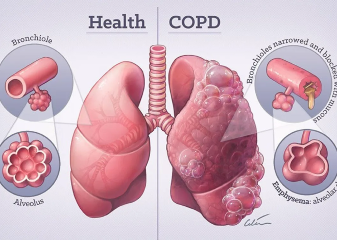 Exercises to Improve Lung Function in COPD Patients