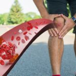 Actual Locked Knee Explained: Common Causes and Prevention Tips