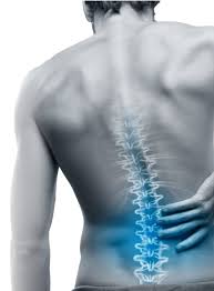 Understanding Chronic Back Pain: A Comprehensive Guide