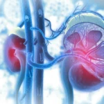 How Can I Heal My Kidneys Naturally