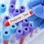 Understanding Prolactin: An In-depth Exploration