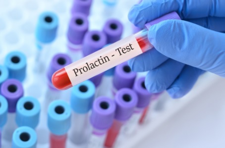 Understanding Prolactin: An In-depth Exploration