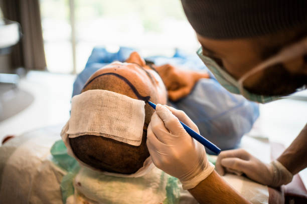 Male hair transplant in Abu Dhabi