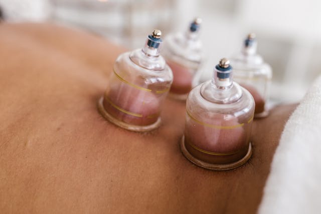 hijama